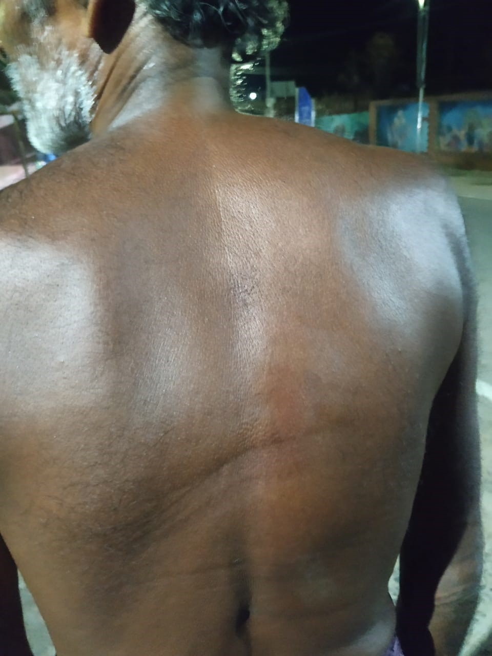 ପୋଲିସର ଥାର୍ଡ ଡିଗ୍ରୀ ଅଭିଯୋଗ !